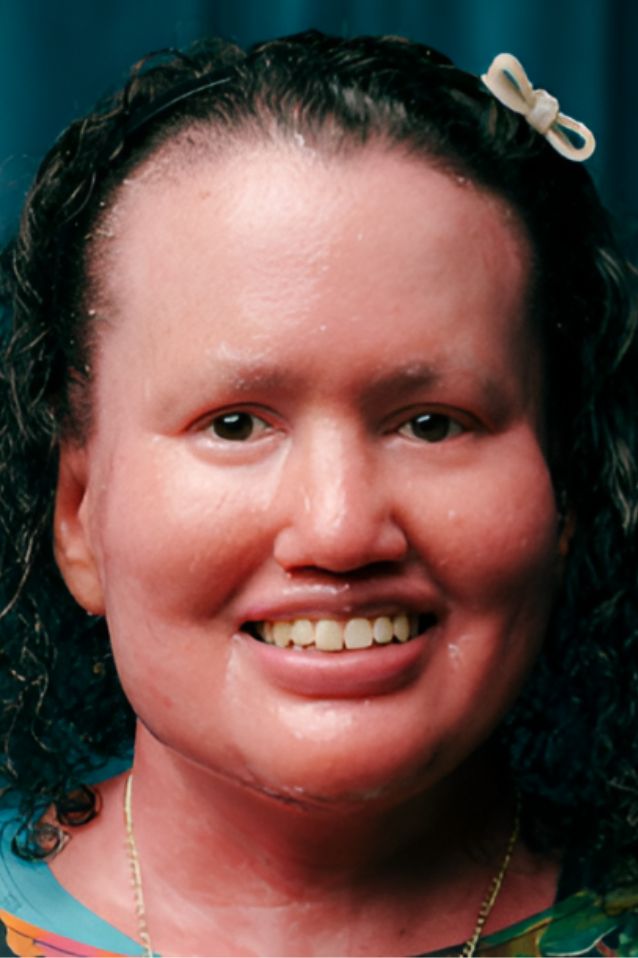 Carly Findlay OAM