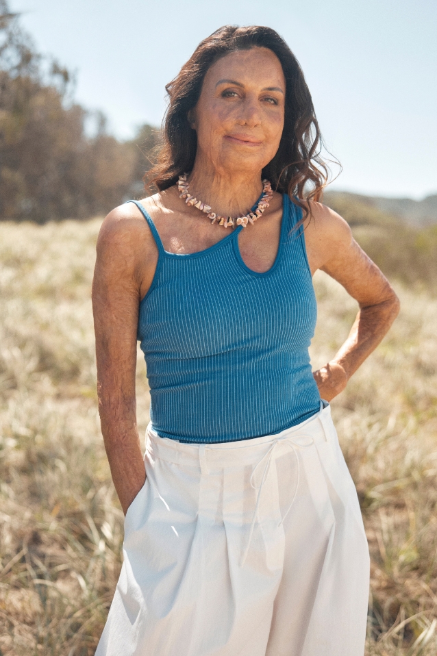 Turia Pitt